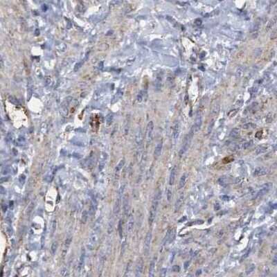 Immunohistochemistry-Paraffin: COBL Antibody [NBP1-89616]