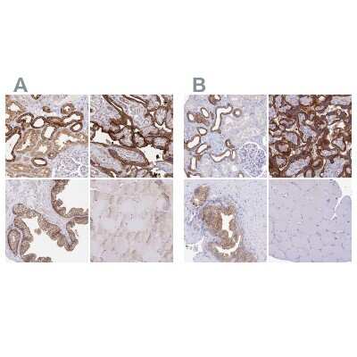 Immunohistochemistry-Paraffin: COBLL1 Antibody [NBP2-38697]