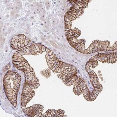 Immunohistochemistry-Paraffin: COBLL1 Antibody [NBP2-38697]