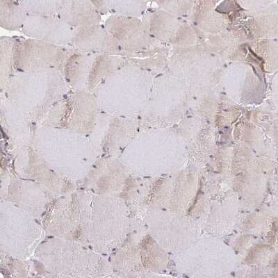 Immunohistochemistry-Paraffin: COBLL1 Antibody [NBP2-38697]