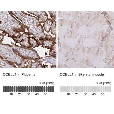 Immunohistochemistry-Paraffin: COBLL1 Antibody [NBP2-38697]