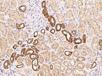 Immunohistochemistry-Paraffin: COBLL1 Antibody [NBP2-98671]