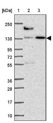 Western Blot: COBLL1 Antibody [NBP2-38697]