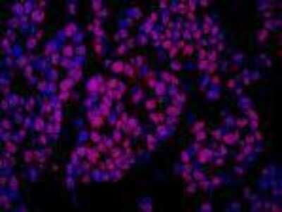 Immunohistochemistry-Paraffin: COBRA1 Antibody [NBP1-05977]