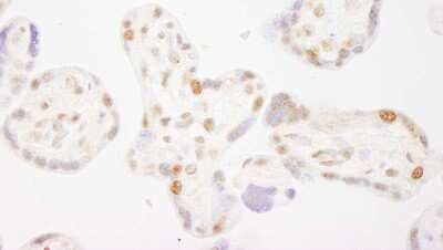 Immunohistochemistry-Paraffin: COBRA1 Antibody [NBP1-05977]