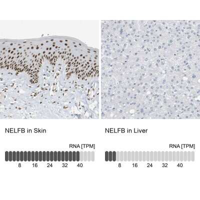 Immunohistochemistry-Paraffin: COBRA1 Antibody [NBP1-82924]