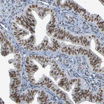 Immunohistochemistry-Paraffin: COBRA1 Antibody [NBP1-82924]