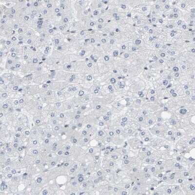 Immunohistochemistry-Paraffin: COBRA1 Antibody [NBP1-82924]