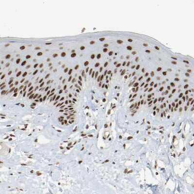 Immunohistochemistry-Paraffin: COBRA1 Antibody [NBP1-82924]