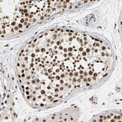 Immunohistochemistry-Paraffin: COBRA1 Antibody [NBP1-82924]