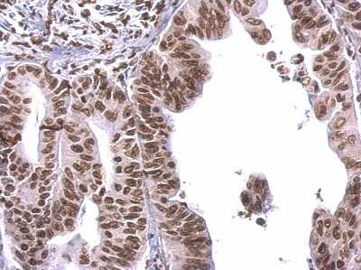 Immunohistochemistry-Paraffin: COBRA1 Antibody [NBP2-15935]