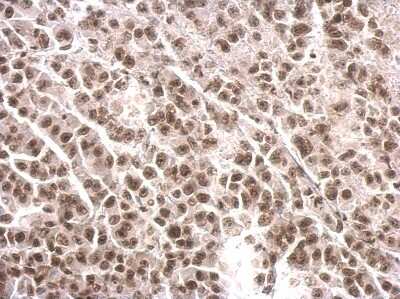 Immunohistochemistry-Paraffin: COBRA1 Antibody [NBP2-15935]