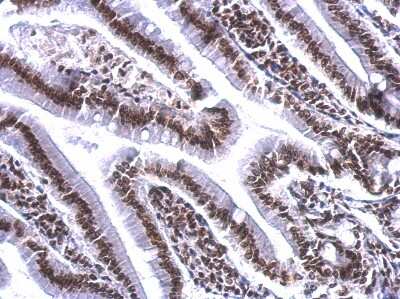 Immunohistochemistry-Paraffin: COBRA1 Antibody [NBP2-15935]