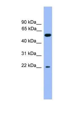 Western Blot: Cochlin Antibody [NBP1-69141]