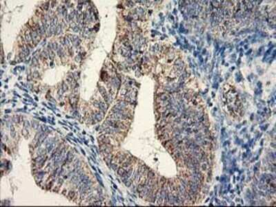 Immunohistochemistry: COCO/DAND5 Antibody (OTI2H3) - Azide and BSA Free [NBP2-72456]