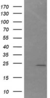 Western Blot: COCO/DAND5 Antibody (OTI3D4)Azide and BSA Free [NBP2-72457]