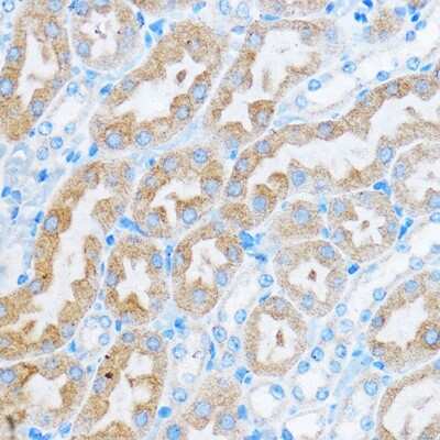 Immunohistochemistry-Paraffin: COG1 Antibody - Azide and BSA Free [NBP3-15543]