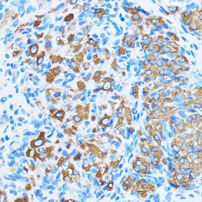 Immunohistochemistry-Paraffin: COG1 Antibody - Azide and BSA Free [NBP3-15543]