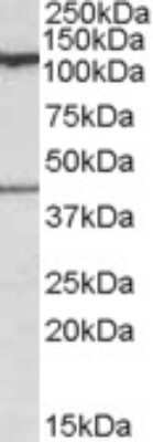 Western Blot: COG1 Antibody [NBP1-28468]