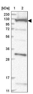 Western Blot: COG1 Antibody [NBP1-81414]