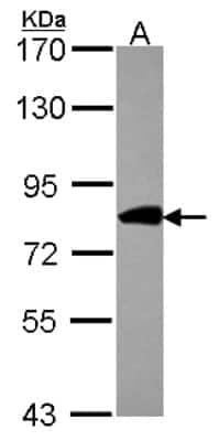 Western Blot: COG2 Antibody [NBP2-15936]