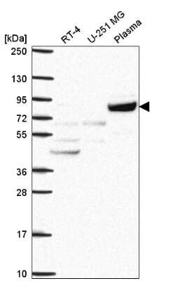 Western Blot: COG2 Antibody [NBP2-57681]