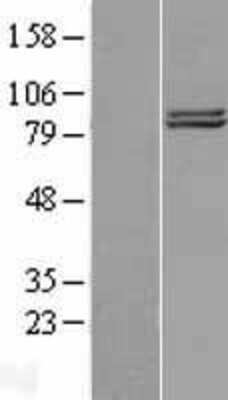 Western Blot: COG2 Overexpression Lysate [NBL1-09344]