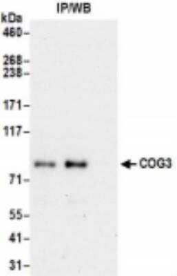 Immunoprecipitation: COG3 Antibody [NBP2-36540]