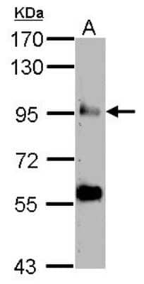 Western Blot: COG3 Antibody [NBP2-15937]