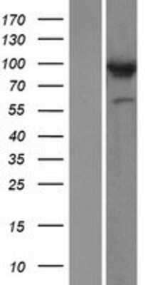 Western Blot: COG3 Overexpression Lysate [NBP2-06127]