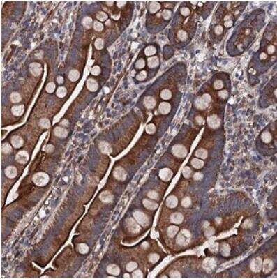 Immunohistochemistry-Paraffin: COG4 Antibody [NBP2-30718]