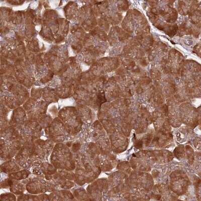 Immunohistochemistry: COG4 Antibody [NBP2-48766]