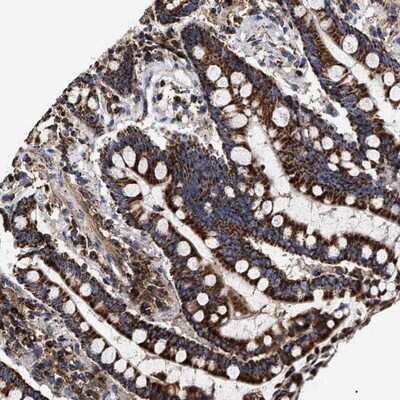 Immunohistochemistry-Paraffin: COG5 Antibody [NBP1-93713]