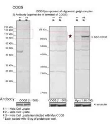 Western Blot: COG5 Antibody [NBP1-91374]