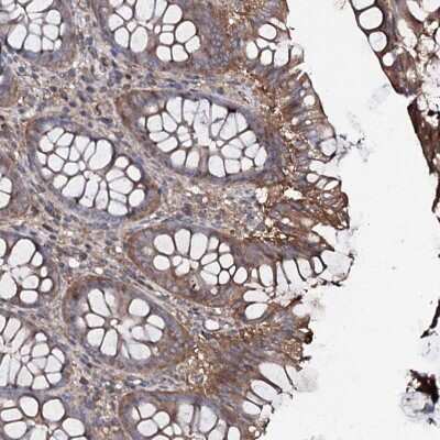 Immunohistochemistry-Paraffin: COG6 Antibody [NBP1-84410]
