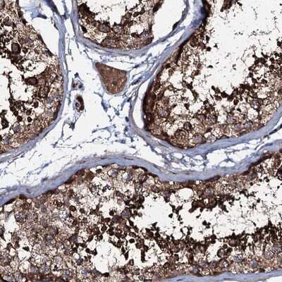 Immunohistochemistry-Paraffin: COG6 Antibody [NBP1-84411]