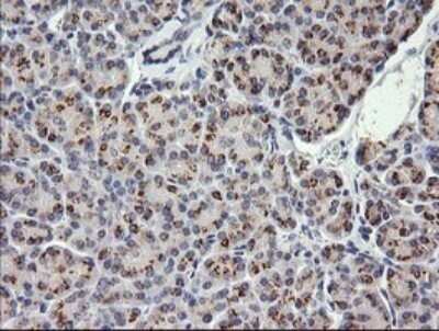 Immunohistochemistry: COG6 Antibody (OTI1B8) - Azide and BSA Free [NBP2-72088]