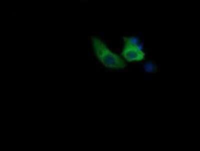 Immunofluorescence: COG6 Antibody (OTI1B8) [NBP2-45631]