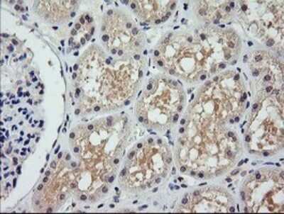 Immunohistochemistry: COG6 Antibody (OTI1B8) [NBP2-45631]