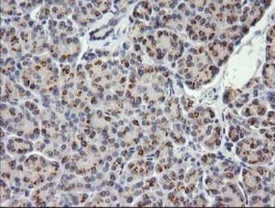 Immunohistochemistry: COG6 Antibody (OTI1B8) [NBP2-45631]