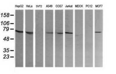 Western Blot: COG6 Antibody (OTI1B8) [NBP2-45631]