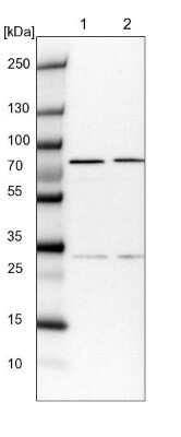 Western Blot: COG6 Antibody [NBP1-84410]