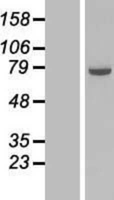 Western Blot: COG6 Overexpression Lysate [NBL1-09345]