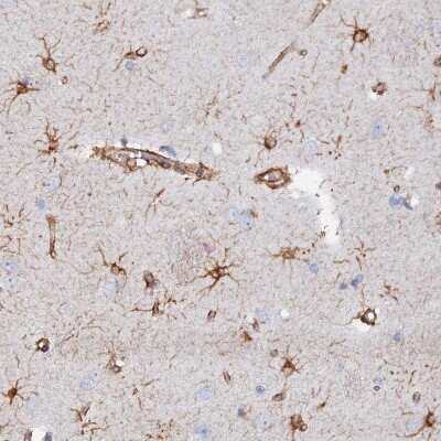 Immunohistochemistry-Paraffin: COG7 Antibody [NBP2-47502]