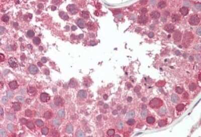 Immunohistochemistry-Paraffin: COG7 Antibody [NBP1-05032]