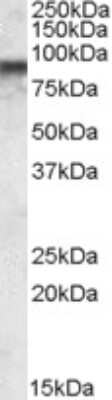 Western Blot: COG7 Antibody [NBP1-05032]