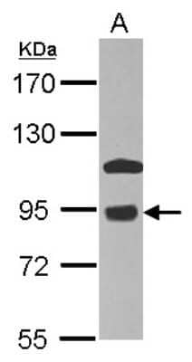 Western Blot: COG7 Antibody [NBP2-14914]