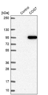 Western Blot: COG7 Antibody [NBP2-47502]