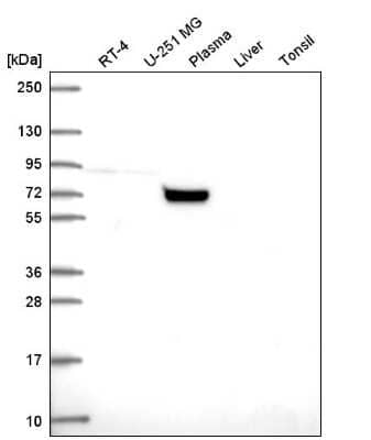 Western Blot: COG7 Antibody [NBP2-56614]