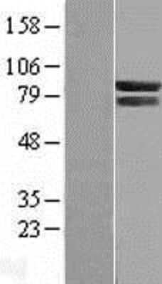 Western Blot: COG7 Overexpression Lysate [NBL1-09346]